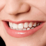 Sonhar com Dentes Bonitos Bicho