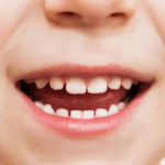 Sonhar com Dente de Criança Bicho