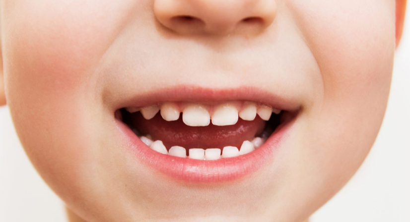 Sonhar com Dente de Criança Bicho