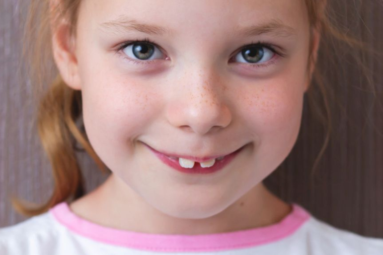 Sonhar com Dente Grande Bicho