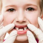 Sonhar com 2 Dentes Caindo Loteria