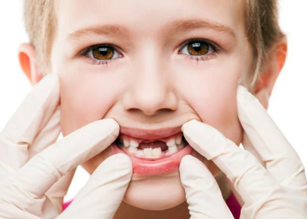 Sonhar com 2 Dentes Caindo Loteria