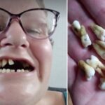 Sonhar com Arrancando o próprio dente com a mão Loteria