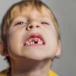 Sonhar com Banguelos Bicho