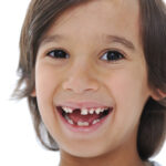 Sonhar com Banguelos Loteria