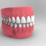 Sonhar com Dentadura Loteria