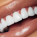 Sonhar com Dente Branco Bicho