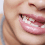 Sonhar com Dente Nascendo Bicho