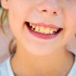 Sonhar com Dente Sujo Loteria