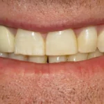 Sonhar com Dentes Amarelos Loteria