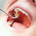 Sonhar com Dentes Doendo Loteria