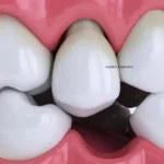 Sonhar com dente mole Loteria